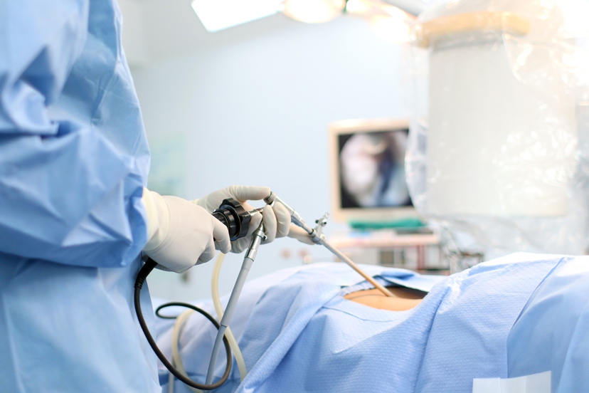 Advanced 3D Laparoscopic Surgery